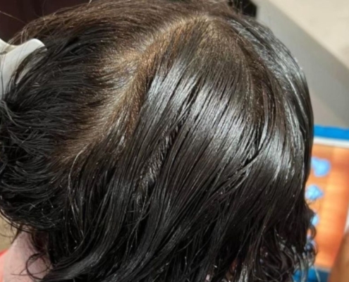 Tips for Choosing a Professional Lice Treatment Service