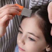 7 Ways To Protect Kids From Lice at Summer Camp