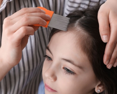 7 Ways To Protect Kids From Lice at Summer Camp