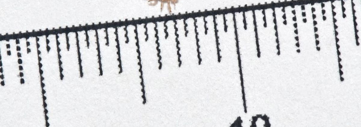 How To Determine How Long You Have Had Head Lice