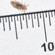 How To Determine How Long You Have Had Head Lice