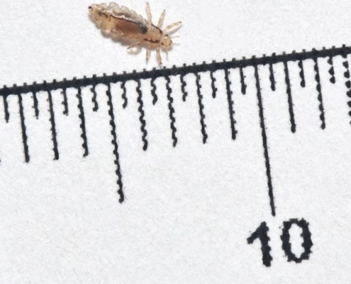 How To Determine How Long You Have Had Head Lice