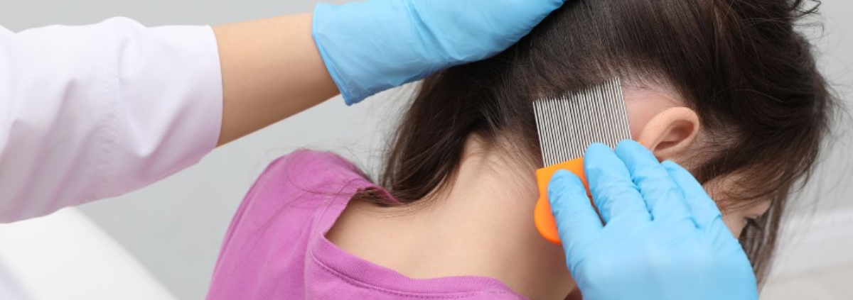 A Guide to Properly Combing Lice and Nits out of Hair