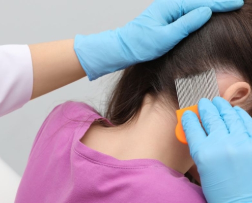 A Guide to Properly Combing Lice and Nits out of Hair