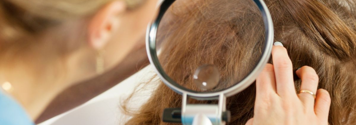 The Benefits of Professional Head Lice Removal Services