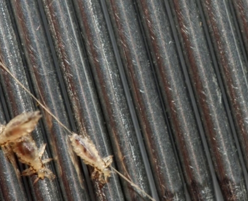 Head Lice, Nits & Eggs: What Do They Look Like?