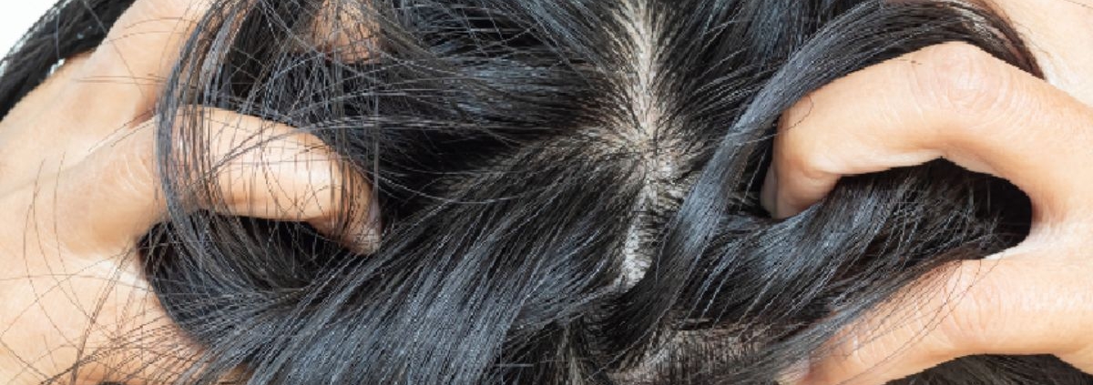 Reasons Your Head Still Itches After Lice Treatment